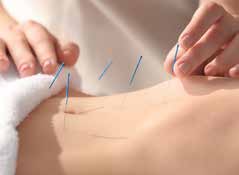 Can acupuncture help me lose weight?